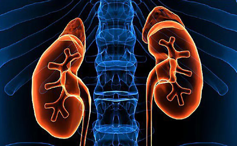 nephrotic syndrome