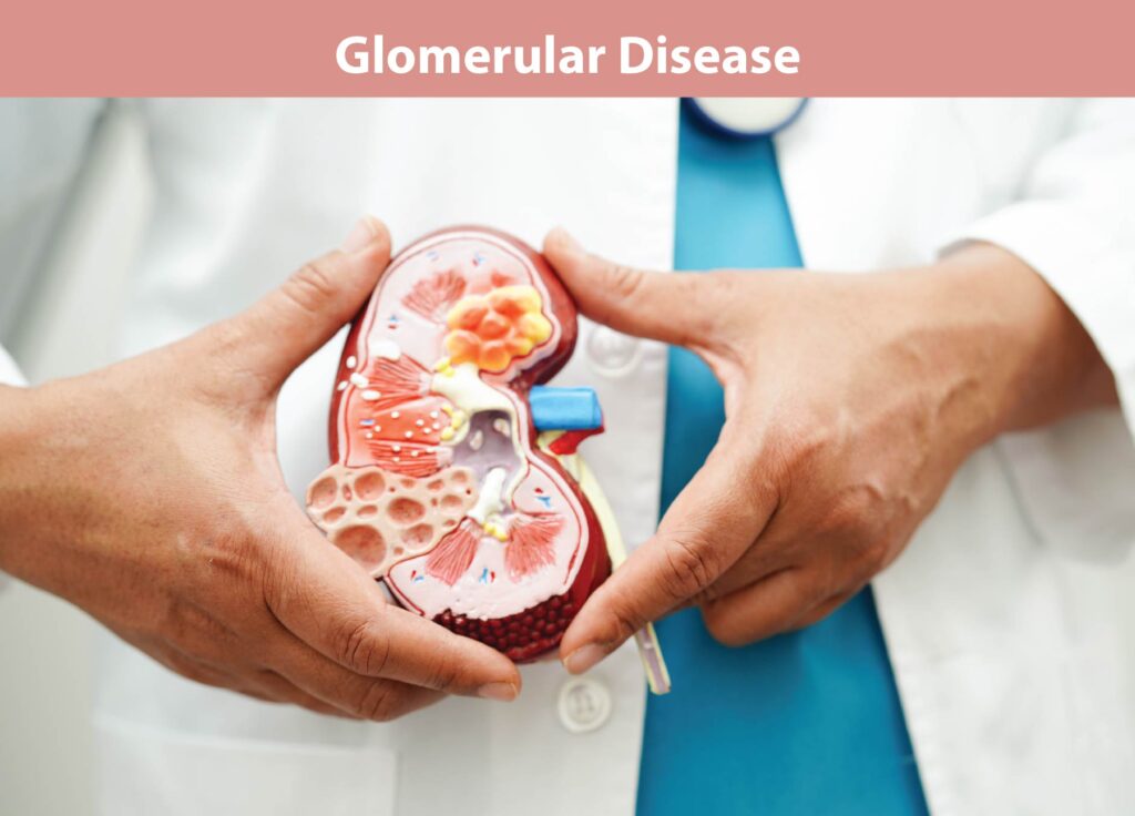 glomerular disease01